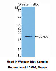 https://msimg.bioon.com/bionline/goods-no-pic.png