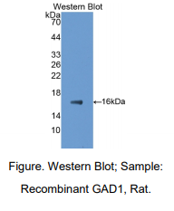 https://msimg.bioon.com/bionline/goods-no-pic.png