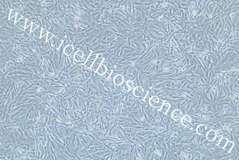 SUM159PT细胞/SUM-159PT细胞/SUM-159PT/SUM159PT/人乳腺癌细胞