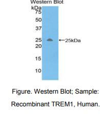 https://msimg.bioon.com/bionline/goods-no-pic.png