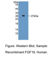 https://msimg.bioon.com/bionline/goods-no-pic.png