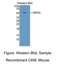 小鼠肌肌酸激酶(CKM)多克隆抗体