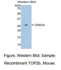 小鼠拓扑异构酶Ⅱβ(TOP2b)多克隆抗体