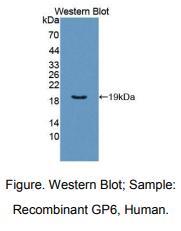 人膜糖蛋白Ⅵ(GP6)多克隆抗体