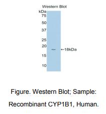 人细胞色素P450家族成员1B1(CYP1B1)多克隆抗体