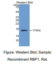 大鼠视黄醇结合蛋白1(RBP1)多克隆抗体