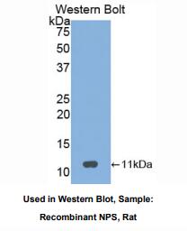 https://msimg.bioon.com/bionline/goods-no-pic.png