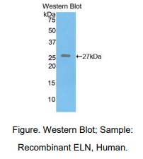 https://msimg.bioon.com/bionline/goods-no-pic.png