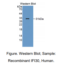 人干扰素γ诱导蛋白30(IFI30)多克隆抗体