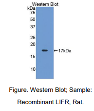 https://msimg.bioon.com/bionline/goods-no-pic.png