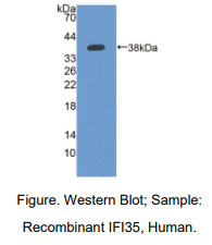 人干扰素诱导蛋白35(IFI35)多克隆抗体