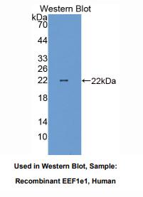 人真核翻译延伸因子1ε1(EEF1e1)多克隆抗体