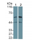 https://msimg.bioon.com/bionline/goods-no-pic.png