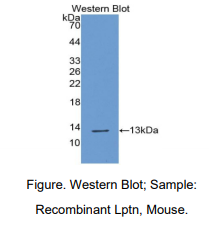 https://msimg.bioon.com/bionline/goods-no-pic.png