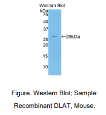 https://msimg.bioon.com/bionline/goods-no-pic.png