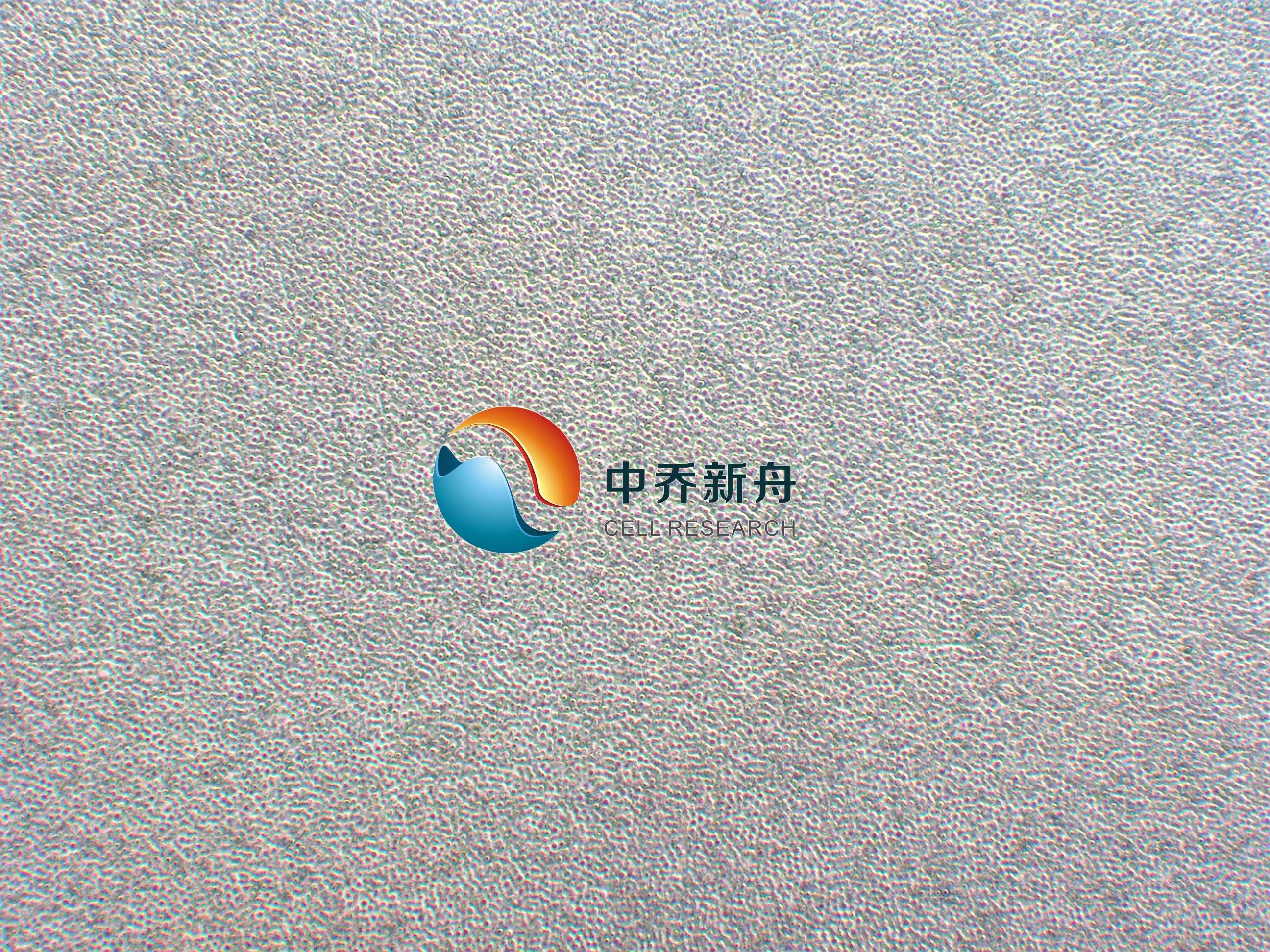 COC1/DDP细胞耐药亚株