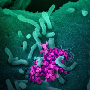 <font color="red">Lancet</font>：科学家建议将新分子成像技术应用于侵袭性癌症常规检查