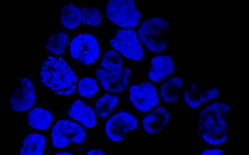 科学家发现，抑制<font color="red">CD36</font>可阻断调节T细胞对肿瘤微环境的适应，增强抗肿瘤活性