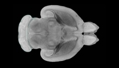 PNAS: 移植的干细胞可修复大鼠中风受损的大脑