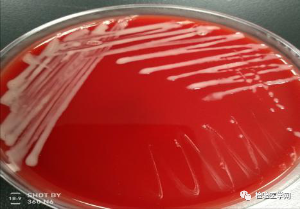 这个细菌竟然<font color="red">会</font>变身？且看它如何现形