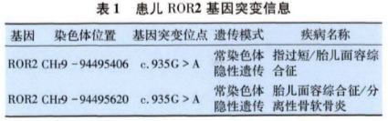 Robinows<font color="red">综合征</font>患儿1例报道