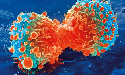 杀死乳腺癌细胞！“网红抗癌药”Venetoclax再显奇效