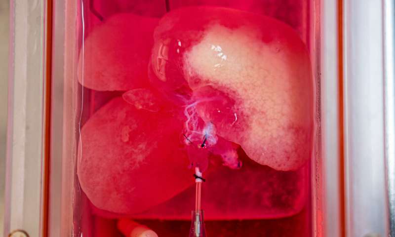 美国科学家培育出<font color="red">人造</font>微型肝脏，在动物体内已经移植成功了！