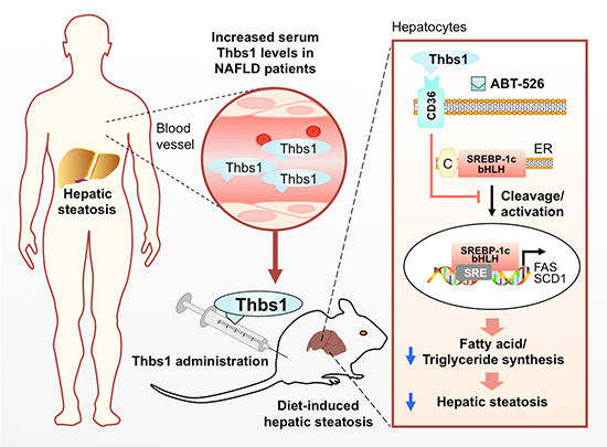 EBioMedicine：Thbs1——可能是非酒精性脂肪肝的新型生物标志物与治疗靶点