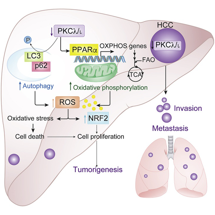 Cancer cell：重大发现！一种代谢酶能抑制肝癌细胞的生长和扩散
