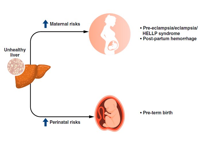 J Hepatol：<font color="red">妊娠期</font>非酒精性脂肪性肝病与孕产妇及围产期不良结局相关