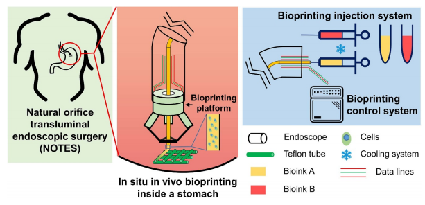 Biofabrication: 清华大学徐弢团队首次利用微型机器人+体内生物打印治疗胃创伤