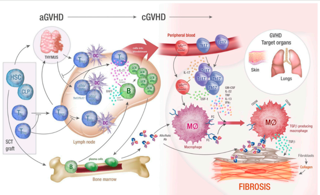 移植物抗宿主病（GVHD）新药开发攻略