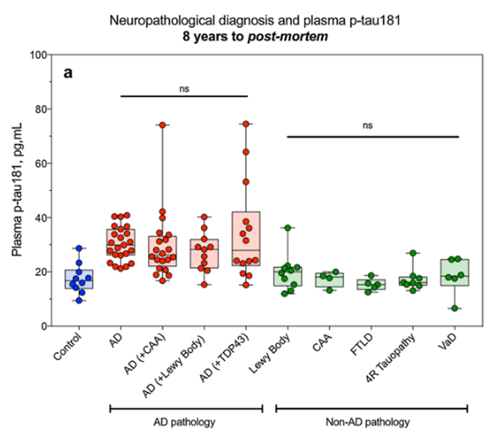 Acta Neuropathologica: 血浆<font color="red">p-tau</font> 181至少在死亡前8年能准确预测阿尔茨海默病的病理并且改善认知功能衰退的临床特征