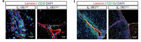 Acta Neuropathologica: IL-1通过抑制血脑<font color="red">屏障</font><font color="red">内皮</font>血红素氧合酶-1促进自身免疫性神经炎症