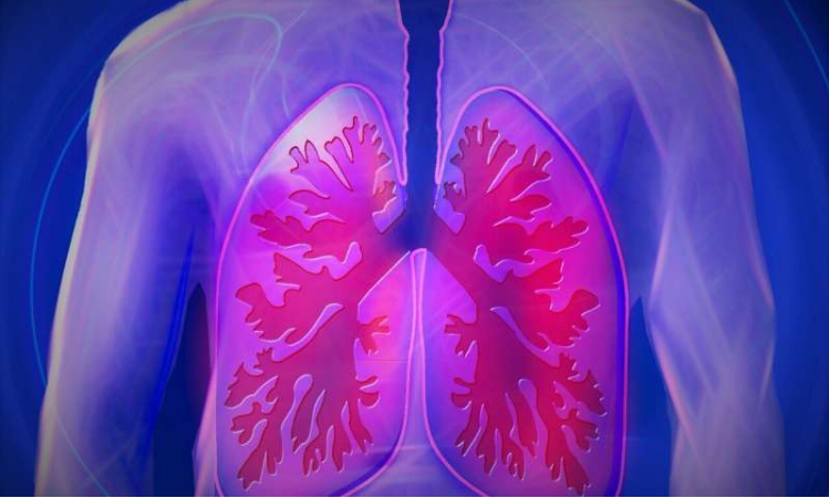 Nature：<font color="red">斯坦福</font>大学的研究小组制作出人类肺的细胞图谱，可用于研究肺部疾病