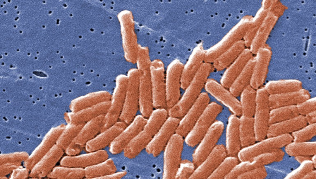 美国加拿大暴发沙门氏菌感染它是导致腹泻的重要元凶