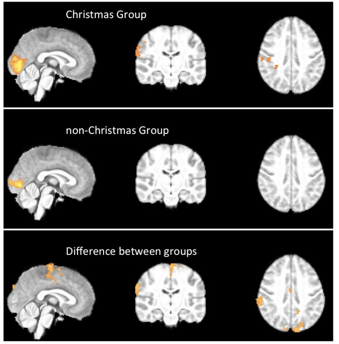 BMJ | 圣诞节期间，大脑发生了什么？