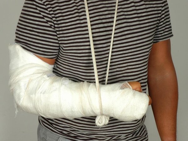 沙雕新闻丨骨科医生掰手腕骨折，给自己开药！掰手腕会骨折吗？