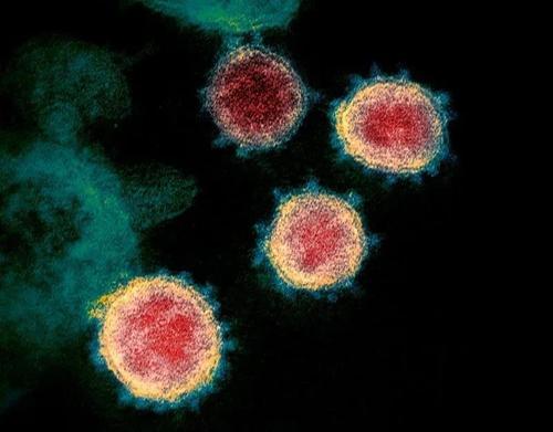 Nat Commu：两项研究显示新冠病毒感染后产生抗体两个月内迅速衰减