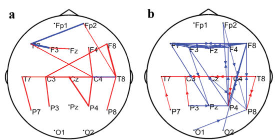 Fig. 3. - The significantly different (p < 0.01) connectivity strengths between RE-no-SA patients and MCE patients using functional and effective networks in the most distinct frequency band from (a) The beta band functional network. (b) The effective network in the full frequency band. Red lines represent the stronger connectivity strengths for RE-no-SA patients compared to MCE patients, and the blue lines mean the weaker connectivity strengths.