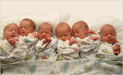 医学奇迹，一产妇一口气生下9胞胎