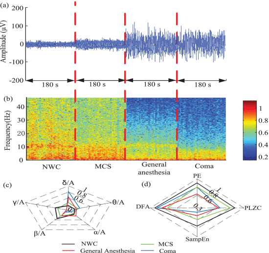 Fig. 3. - The EEG recordings and their multi-dimensional measurements. (a) Constructed EEG recordings from four subjects with NWC, MCS, general anesthesia, and coma. The EEG data recorded from the prefrontal area and data length of each state was 180 s. All data were resampled to 100 Hz. (b) The normalized power spectrograms of the EEG recordings were computed by a short-time Fourier transform (using a 10 s hamming window, 75% overlapping). The dark red indicates higher power, and the blue indicates lower power. (c) The constructed multi-dimensional parameter space is based on the RP in the delta, theta, alpha, beta, and gamma. The center of the pentagons is 0, and the different colors represents the different states. (d) The constructed multi-dimensional parameter space was constructed based on the non-linear measurements of PE, PLZC, SampEn, and DFA.