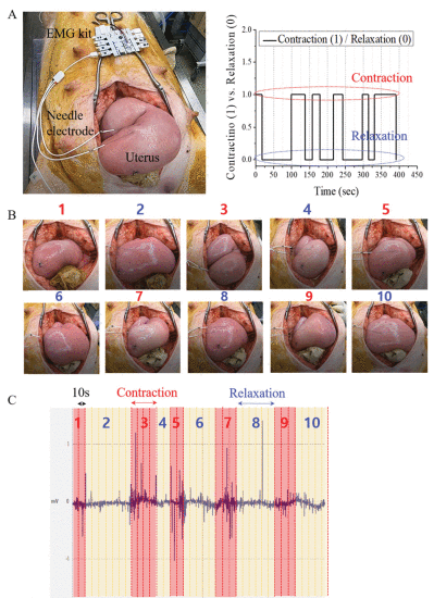 Fig. 7. - Open abdominal surgery for the EMG signal recording of the pregnant minipig uterus using the commercial EMG kit and micro-needle electrodes (left) and the duration of the handwriting time plot for contraction (1) and relaxation (0) (right) (A); Photograph images of the uterus by repetitive contraction and relaxation (red color and blue color mean contraction and relaxation, respectively) (B); Recorded EMG signal for the uterus of pregnant minipig (C).