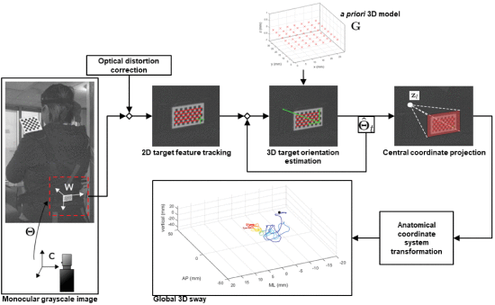 Fig. 1. - Overview of the monocular 3D sway estimation imaging system. Frames were captured posterior to the participant. Target features were tracked in 2D, and using a priori 3D geometric model, 3D sway coordinates were estimated and transformed into anatomical space. Upper and lower trunk sway coordinates were estimated by tracking shoulder and lumbar targets, resulting in a global 3D sway profile (blue: early stance, red: late stance).