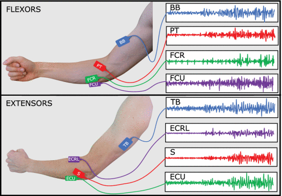 Fig. 3. - Approximate locations for each EMG electrode labeled by muscle. Muscles that contribute primarily to E-Flx/Ext are marked in blue, F-Pro/Sup in red, W-Flx/Ext in green, and W-Rad/Uln in purple. The right portion of the figure shows examples of filtered EMG waveforms from an isometric contraction in the Elbow-Forearm multi-DoF mode.