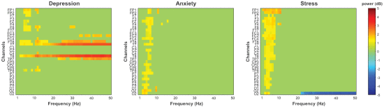 Fig. 6. - Group-averaged differences in the resting-state EEG power spectral density between the increased and normal levels of depression, anxiety and stress for all channels as per extended international 10â20 system of electrodes placement, and frequencies in 1â50 Hz range with a step of 1 Hz. The difference is calculated by subtraction of the normal from increased group average PSD values for each cell. The cells that do not pass the 
${p} < 0.05$
 with FDR statistical threshold are set to zero on the plot for visual clarity.