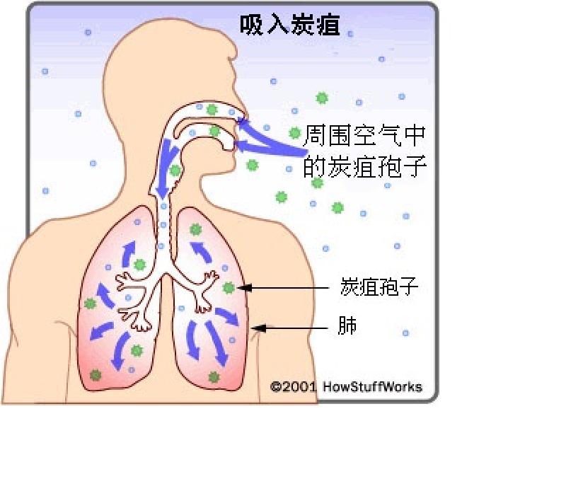 北京市报告1例外地来京就诊肺炭疽病例，炭疽<font color="red">知识</font>简答