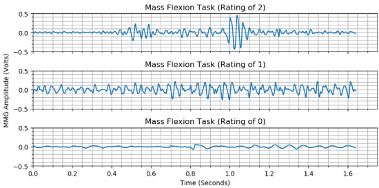 Fig. 2. - Plots of filtered MMG response recorded during the mass flexion task of the FMA-UE. Each plot is taken from a different subject who scored a different rating for this task (0, 1, and 2).