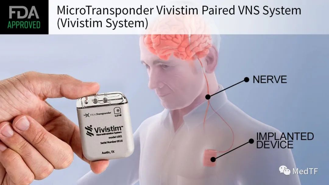 FDA 批准首个卒中康复器械---迷走神经刺激Vivistim