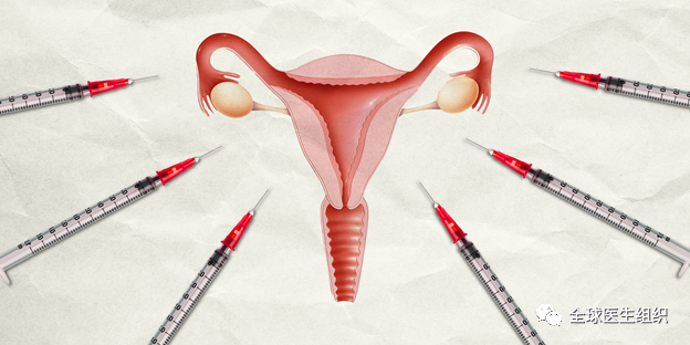 BMJ：<font color="red">新</font><font color="red">冠</font>疫苗接种可能影响女性月经周期